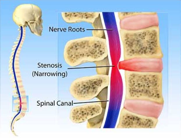 spinal-issues